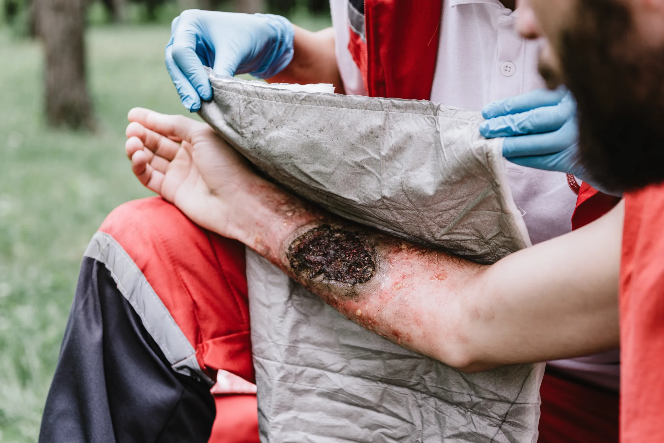 Understanding the Effects of Krokodil